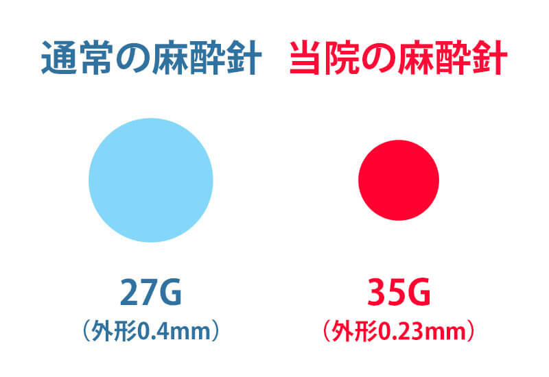 35Gの麻酔注射針