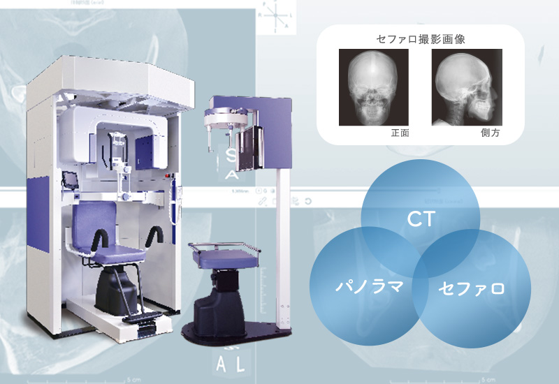 歯科用CT NAOMI-CTセファロ付き