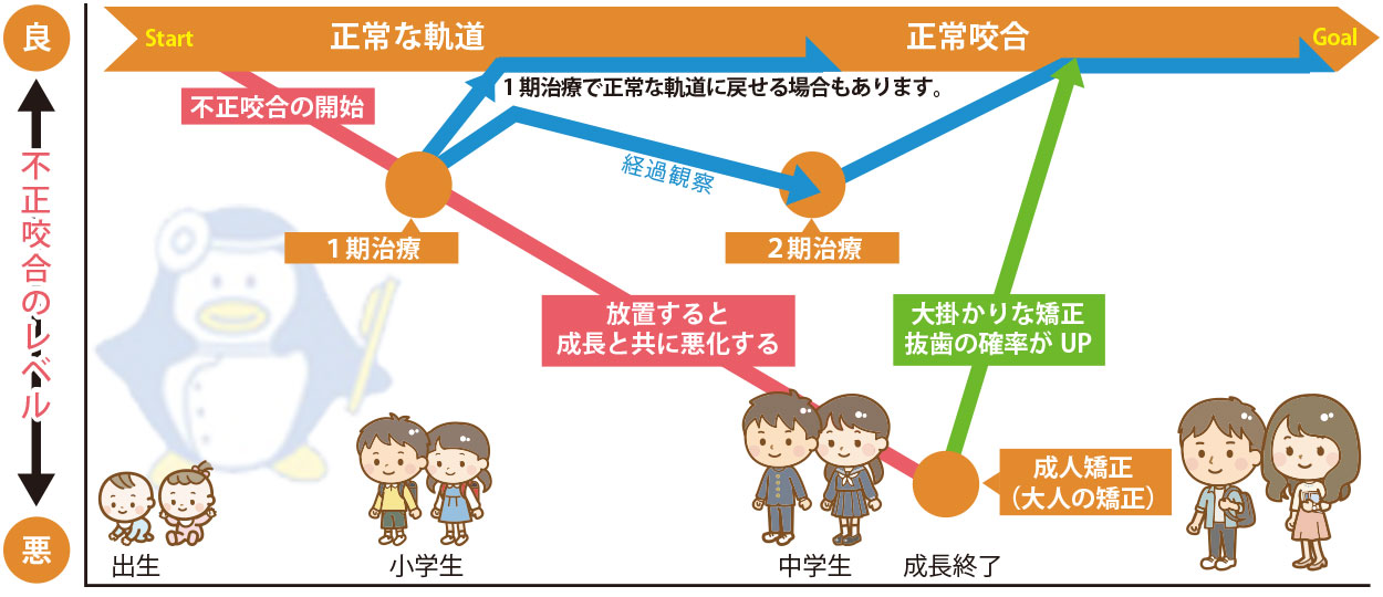 小児矯正歯科治療の進め方