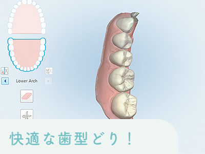 快適に歯型採りができる